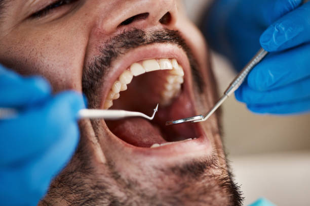 Best Emergency Denture Repair in Emmitsburg, MD